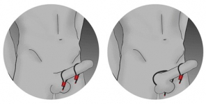 COCK-RING RUBBER/ALU ELECTRASTIM