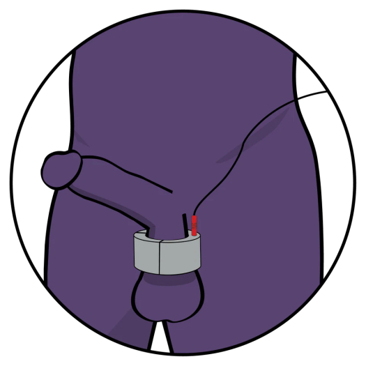 BALLSTRETCHER ELECTRO – 20MM