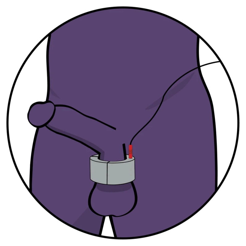 BALLSTRETCHER ELECTRO – 20MM